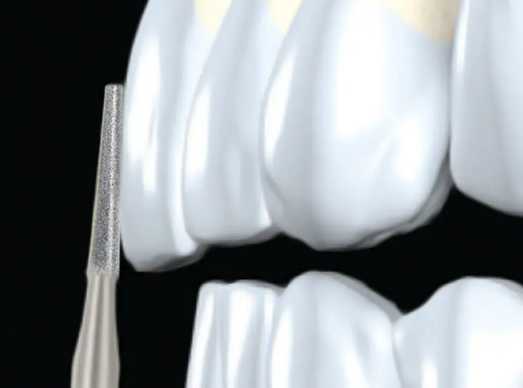 taper-flat-bur_1_.webp