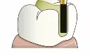 category-gd-_0006_ms_re_cylinder-600x480_2.webp