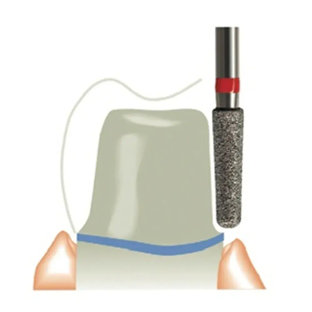 [TR-11] #TR بيرات تيبر راوند Tapered Round (TR-11, لوستر فرنسي).webp