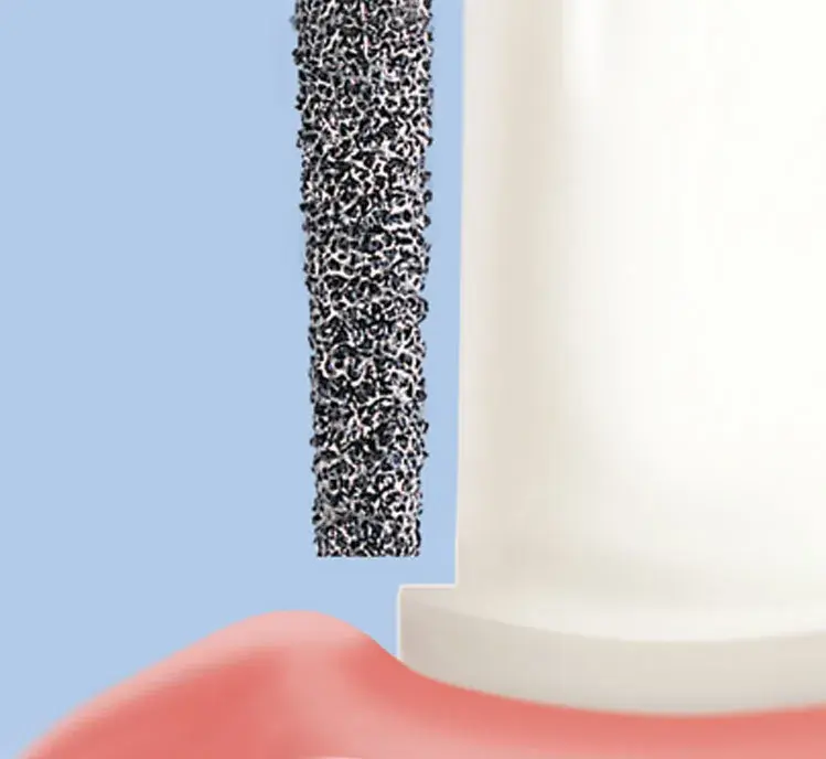 #TF بيرات تيبر فشر Taper Fissure (TF-12EF).webp