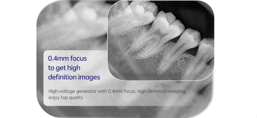 Dental-X-Ray-1688-1.webp