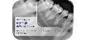 Dental-X-Ray-1688-1.webp