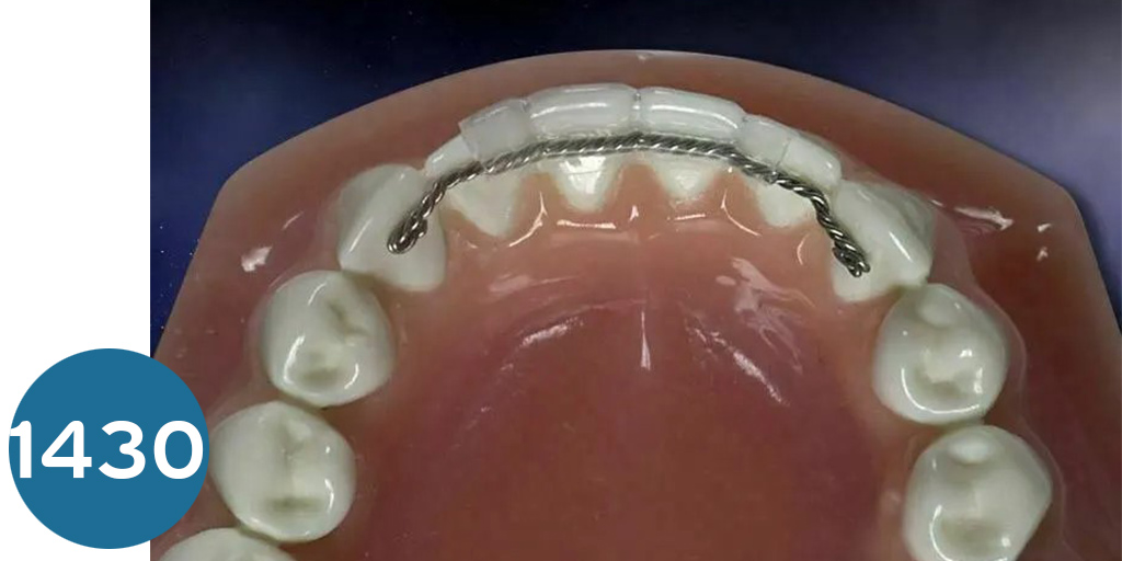 [ريتاينر] سلك تثبيت لنجوال ريتاينر برازيلي  Strands Twist Wires