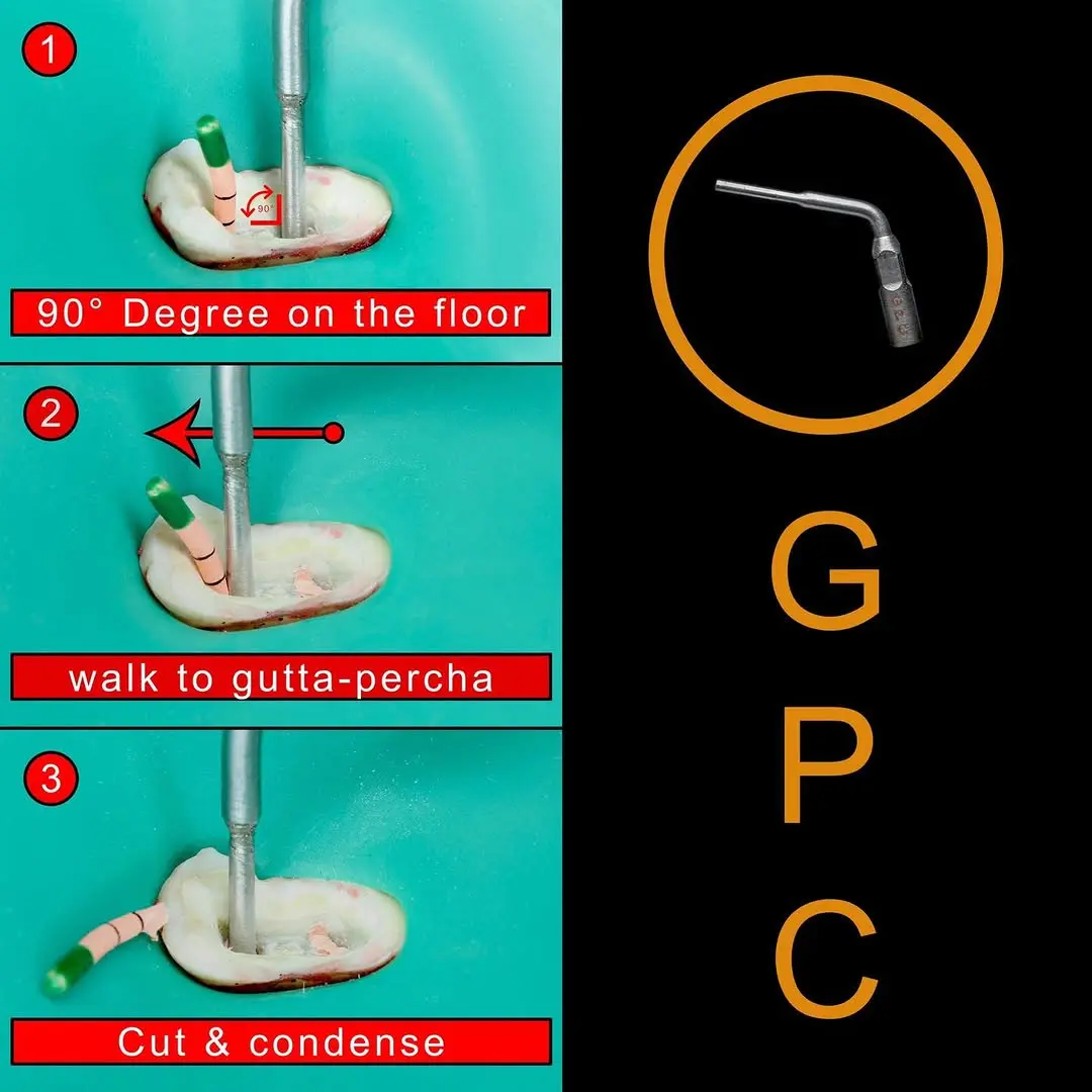 ultrasonic tip to cut and condense gutta-percha (GPC)