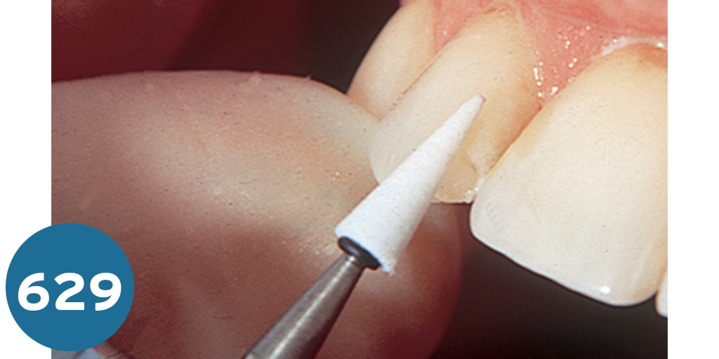 [بوليشنج ستون] بوليشنج ستون  Dura White Stones