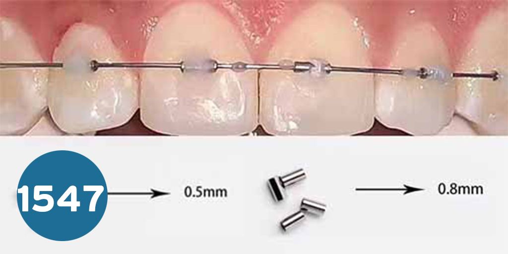 [008-0153] Arch wire stop استوبر تقويم