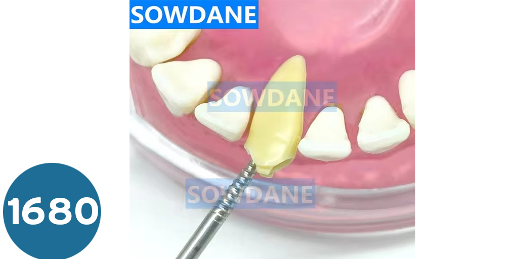 لخلع الجذور  Root Tooth Extraction Screw