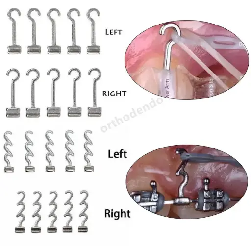 هوك تقويم  orthodontic sliding hook (4 pcs)