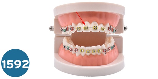 [مجسمات &ديكورات] موديل اسنان تقويم  Orthodontic Teeth Model